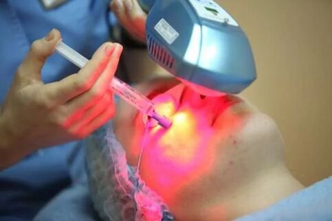 Laserowa biorewitalizacja skóry twarzy