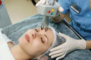 Laserowe frakcyjne odmładzanie skóry twarzy
