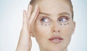 rodzaje blefaroplastyki do odmładzania skóry wokół oczu